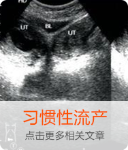 习惯性流产
