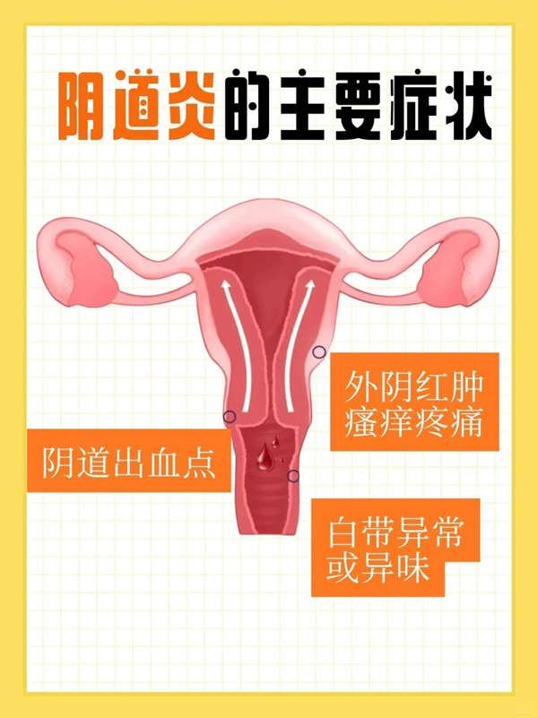 深圳婦科炎症治療