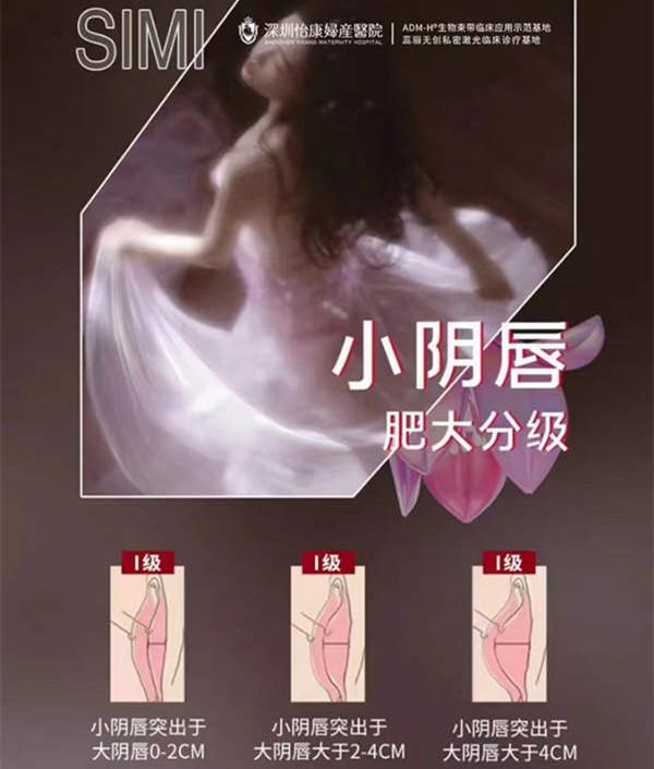 大陸陰唇整形價錢