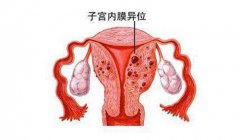 深圳女性尿道炎症状有什么