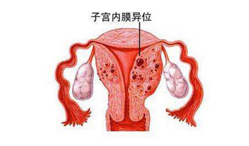 阴道炎反复发作的原因