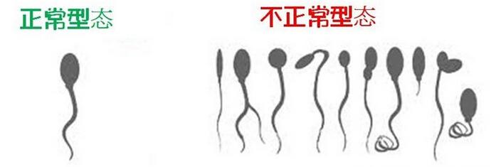 jingzi.jpg